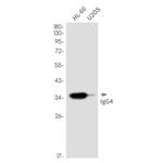 Human IgG4 Antibody in Western Blot (WB)