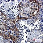 IDE Antibody in Immunohistochemistry (Paraffin) (IHC (P))