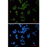 H3K14ac Recombinant Rabbit Monoclonal Antibody (K01_2Q18)