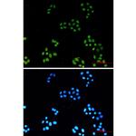 H3K4ac Recombinant Rabbit Monoclonal Antibody (K01_2Q20)