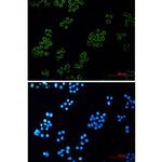 Kappa Light Chain Recombinant Rabbit Monoclonal Antibody (K01_2Q22)