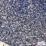 Kappa Light Chain Antibody in Immunohistochemistry (Paraffin) (IHC (P))