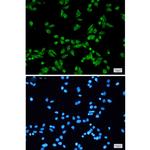 PRPF31 Recombinant Rabbit Monoclonal Antibody (K01_2Q27)