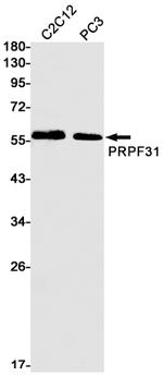PRPF31 Antibody in Western Blot (WB)