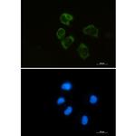 Lysozyme Recombinant Rabbit Monoclonal Antibody (K01_2Q34)