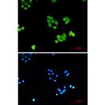 PLK1 Recombinant Rabbit Monoclonal Antibody (K01_2Q37)