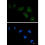 GC Recombinant Rabbit Monoclonal Antibody (K01_2Q40)