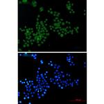 Phospho-Histone H3 (Ser10, Thr11) Antibody in Immunocytochemistry (ICC/IF)