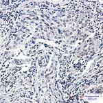 Phospho-Histone H3 (Ser10, Thr11) Antibody in Immunohistochemistry (Paraffin) (IHC (P))