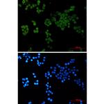 CRCP Recombinant Rabbit Monoclonal Antibody (K01_2Q42)