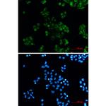 DAB2 Recombinant Rabbit Monoclonal Antibody (K01_2Q43)