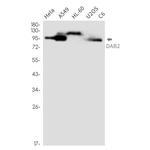 DAB2 Antibody in Western Blot (WB)