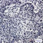 SRSF3 Recombinant Rabbit Monoclonal Antibody (K01_2Q45)