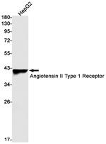 AGTR1 Recombinant Rabbit Monoclonal Antibody (K01_2T82)