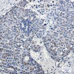 TFAM Antibody in Immunohistochemistry (Paraffin) (IHC (P))