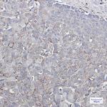 GluR2 Recombinant Rabbit Monoclonal Antibody (K01_2T91)