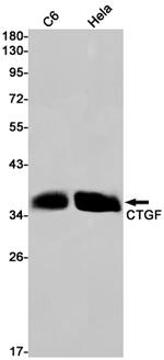 CTGF Antibody in Western Blot (WB)