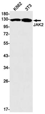 JAK2 Recombinant Rabbit Monoclonal Antibody (K01_2U25)