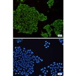 MEK1/MEK2 Recombinant Rabbit Monoclonal Antibody (K01_2U29)