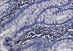 MEK1/MEK2 Antibody in Immunohistochemistry (Paraffin) (IHC (P))