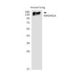 NMDAR2A Recombinant Rabbit Monoclonal Antibody (K01_2U32)