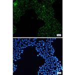 PDHA1 Recombinant Rabbit Monoclonal Antibody (K01_2U36)