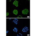 TRIM56 Recombinant Rabbit Monoclonal Antibody (K01_2U46)