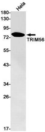 TRIM56 Antibody in Western Blot (WB)