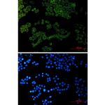 COL1A1 Recombinant Rabbit Monoclonal Antibody (K01_2U53)