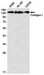 COL1A1 Antibody in Western Blot (WB)