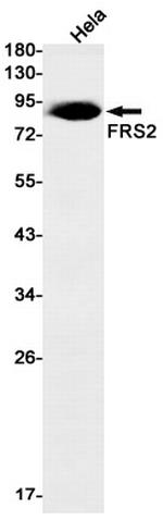 FRS2 Antibody in Western Blot (WB)