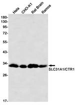 CTR1 Recombinant Rabbit Monoclonal Antibody (K01_2U57)