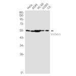 NAMPT Antibody in Western Blot (WB)