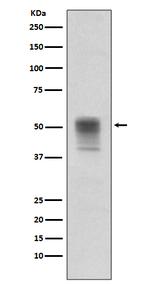 Phospho-Tubulin alpha-1B (Tyr272) Recombinant Rabbit Monoclonal Antibody (K01_2W44)