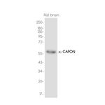 NOS1AP Recombinant Rabbit Monoclonal Antibody (K01_3J65)