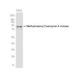 MUT Recombinant Rabbit Monoclonal Antibody (K01_3J69)