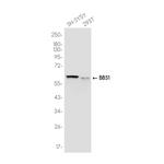 BBS1 Recombinant Rabbit Monoclonal Antibody (K01_3J73)