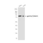 gamma Catenin Recombinant Rabbit Monoclonal Antibody (K01_3J82)