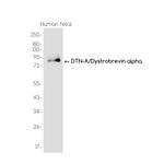 DTNA Recombinant Rabbit Monoclonal Antibody (K01_3J83)