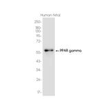 PPAR gamma Recombinant Rabbit Monoclonal Antibody (K01_3J84)