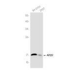 AP2S1 Recombinant Rabbit Monoclonal Antibody (K01_3J85)
