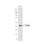 CYP11B2 Recombinant Rabbit Monoclonal Antibody (K01_3J89)