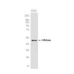 SMPD2 Recombinant Rabbit Monoclonal Antibody (K01_3J92)