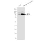 GAA Recombinant Rabbit Monoclonal Antibody (K01_3K03)