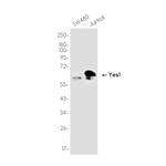 YES1 Recombinant Rabbit Monoclonal Antibody (K01_3K15)