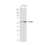 DARS Recombinant Rabbit Monoclonal Antibody (K01_3K19)