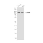 PIK3R4 Recombinant Rabbit Monoclonal Antibody (K01_3K26)