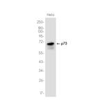 p73 Recombinant Rabbit Monoclonal Antibody (K01_3K31)