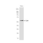 Lyn Recombinant Rabbit Monoclonal Antibody (K01_3K49)