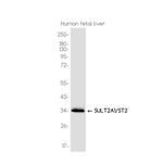 SULT2A1 Recombinant Rabbit Monoclonal Antibody (K01_3K55)